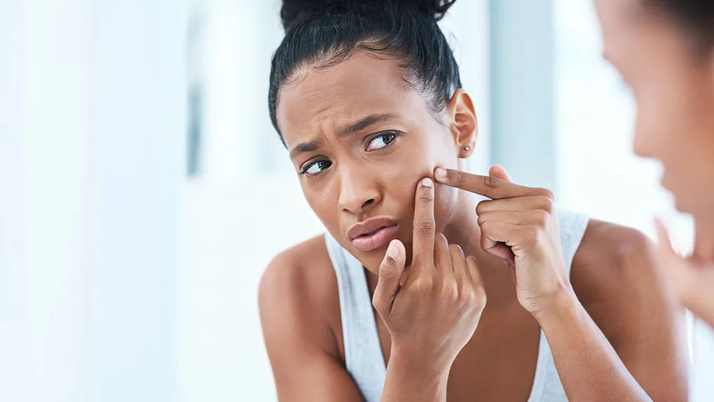 AviClear for Acne-Prone Skin Types: Safe for All Tones and Textures at The Dermatology, Laser & Vein Center in Cincinnati