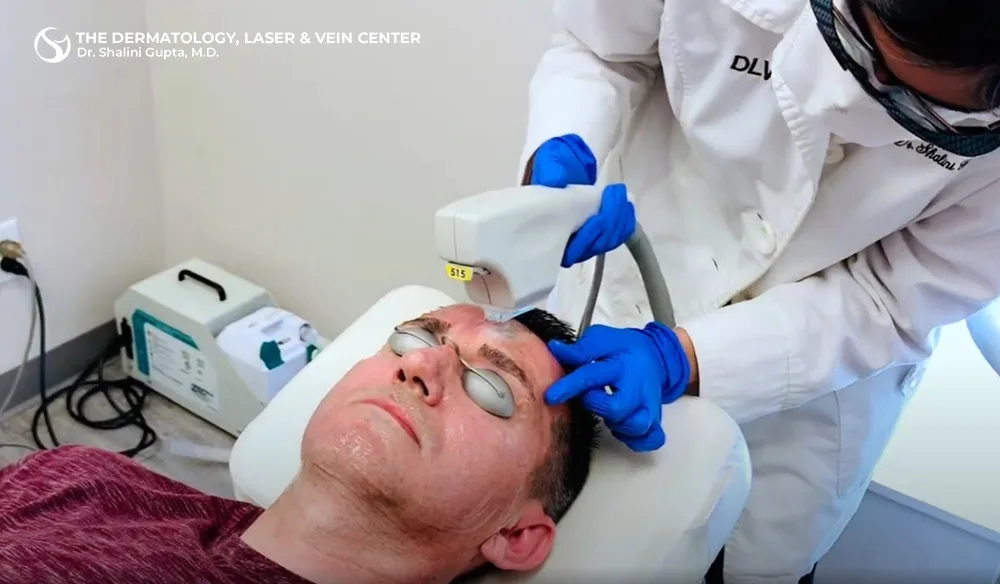Benefits of BBL Skin Resurfacing Treatments in Cincinnati, Ohio at The Dermatology, Laser & Vein Center in Cincinnati