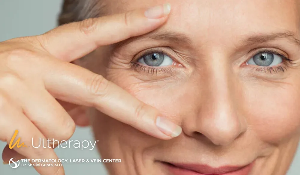 Best Non-Surgical Brow Lift with Ultherapy in Cincinnati, Ohio at The Dermatology, Laser & Vein Center in Cincinnati