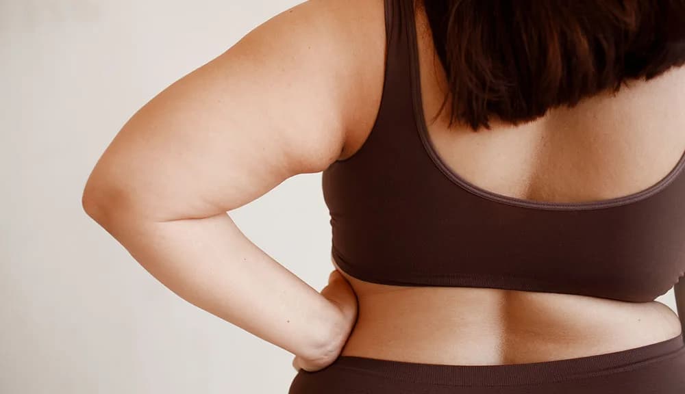 Can Liposuction Remove Arm Fat? at The Dermatology, Laser & Vein Center in Cincinnati
