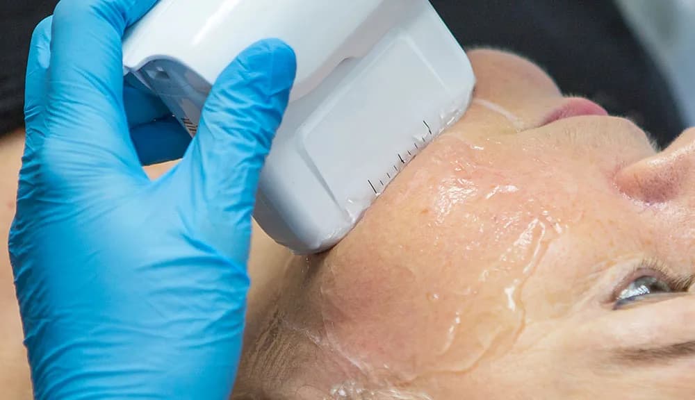 Does Laser Treatment Rejuvenate Skin? at The Dermatology, Laser & Vein Center in Cincinnati
