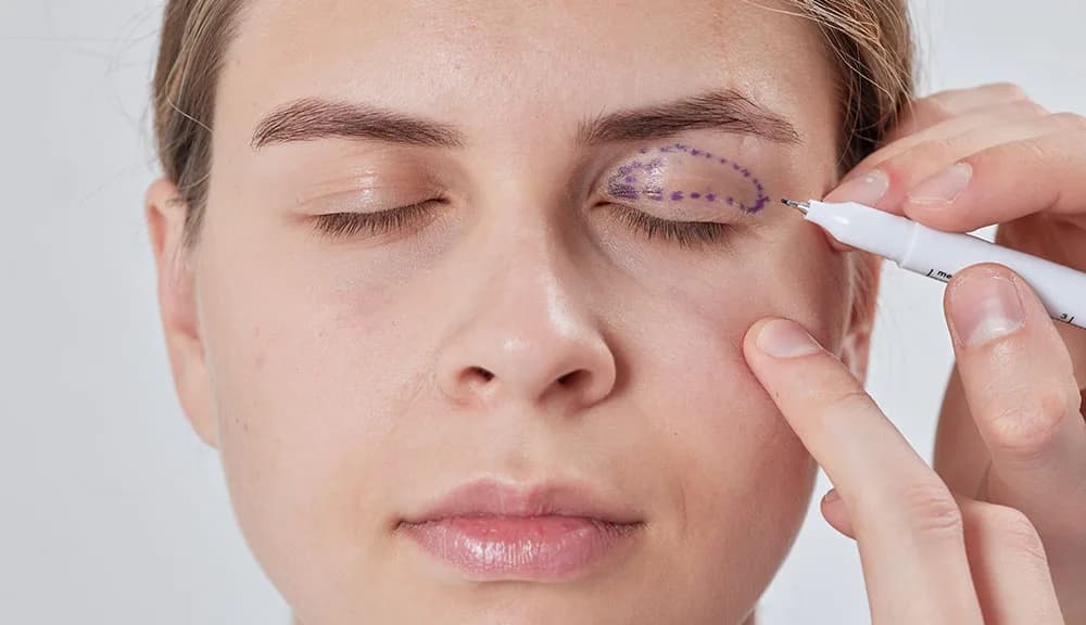 Eyelid Surgery Cincinnati: Rejuvenate Your Facial Appearance at The Dermatology, Laser & Vein Center in Cincinnati