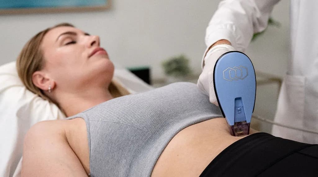 How Does Morpheus8 Help with Skin Tightening? at The Dermatology, Laser & Vein Center in Cincinnati