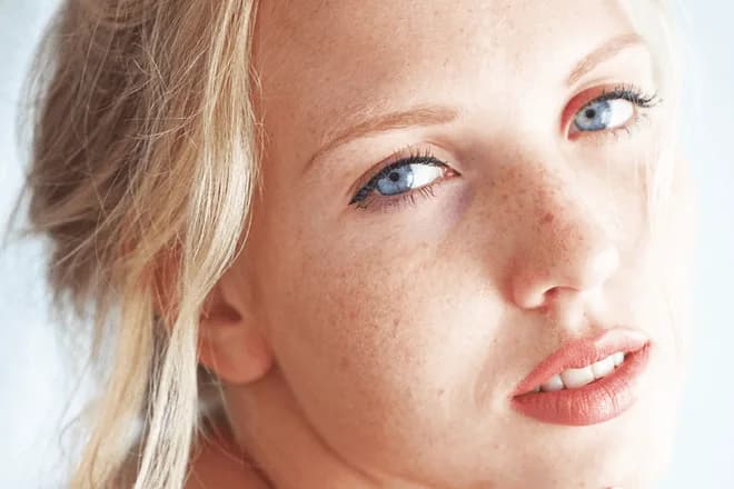 How Long Does a Thermage Treatment Last? at The Dermatology, Laser & Vein Center in Cincinnati