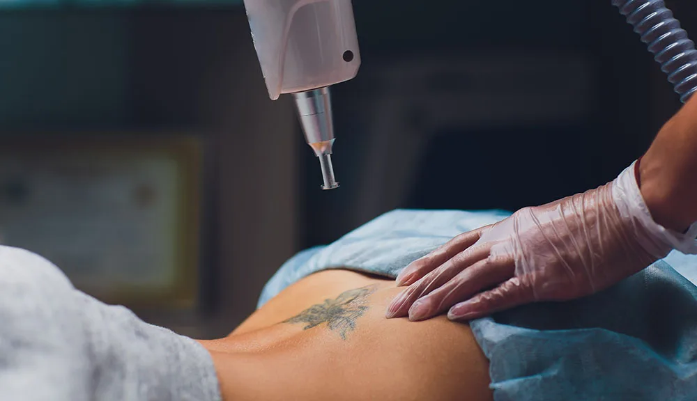 How Painful is Laser Tattoo Removal? at The Dermatology, Laser & Vein Center in Cincinnati