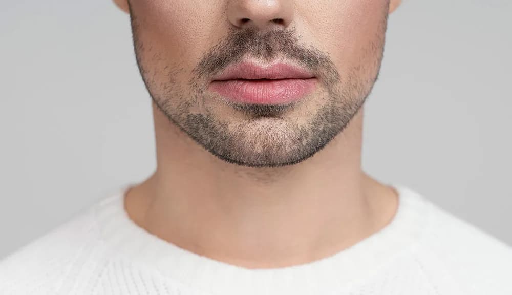 Jawline Filler for Men: Boosting Confidence with a Stronger Jawline at The Dermatology, Laser & Vein Center in Cincinnati