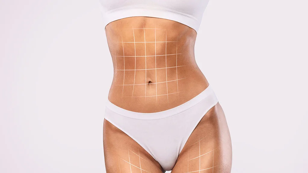 Liposuction vs. Tummy Tuck: Which One Is Right for You? at The Dermatology, Laser & Vein Center in Cincinnati