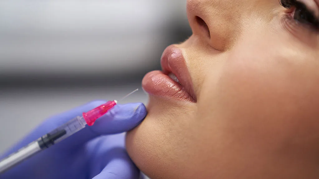 Marionette Line Fillers: Rejuvenate the Corners of Your Mouth at The Dermatology, Laser & Vein Center in Cincinnati