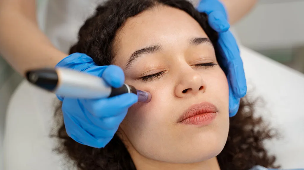 Microneedling Treatments Near Me – Cincinnati, Ohio at The Dermatology, Laser & Vein Center in Cincinnati