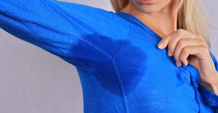 ThermiDry for Hyperhidrosis: How It Works at The Dermatology, Laser & Vein Center in Cincinnati