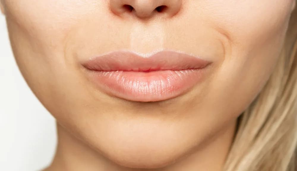 What Is the Most Effective Treatment for Marionette Lines? at The Dermatology, Laser & Vein Center in Cincinnati