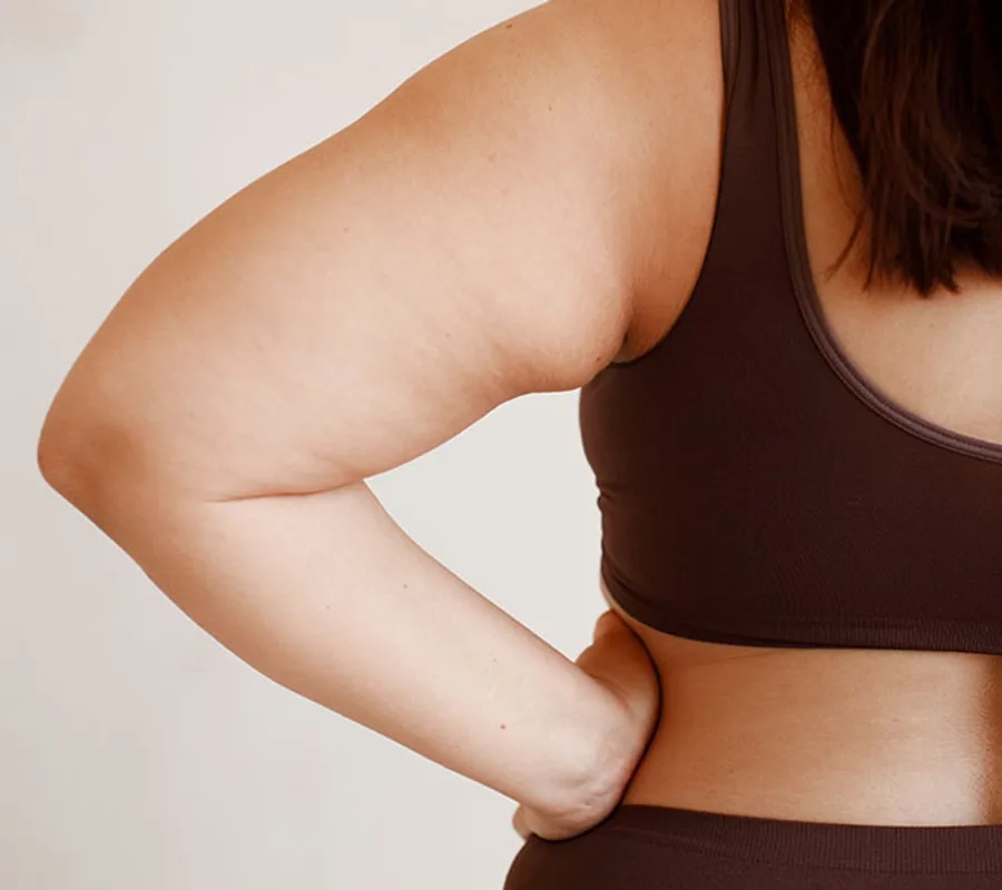 Upper arm of a woman in a sports top showing the loose skin an arm lift removes