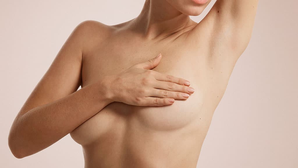 Breast anatomy showing the fold and areolar border where incisions are placed