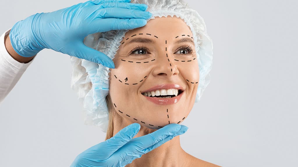 Facelift patient in a surgical cap with pre-operative markings on the face
