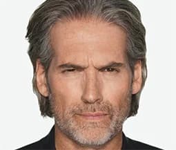 Daxxify, frown lines, before