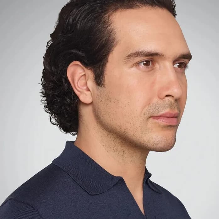 Man with a defined jawline after filler treatment, from Allergan clinical photography