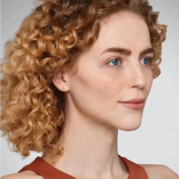 Juvederm, lips and lower face, after