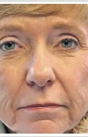 ProFractional, full face, before