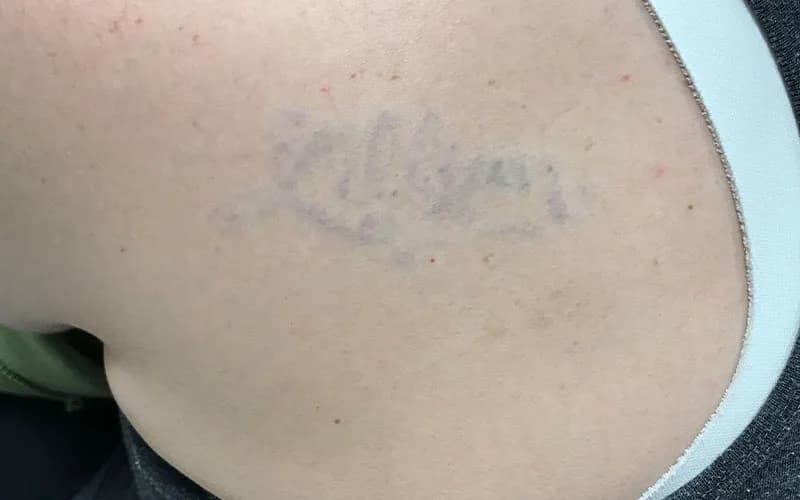 Script tattoo, shoulder, after