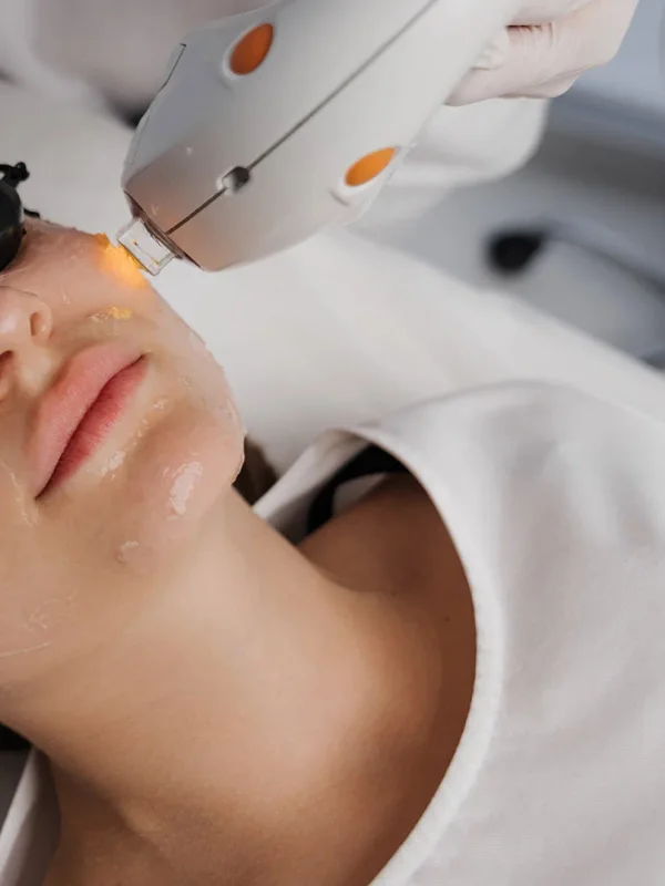 BBL (BroadBand Light) at The Dermatology, Laser & Vein Center in Cincinnati