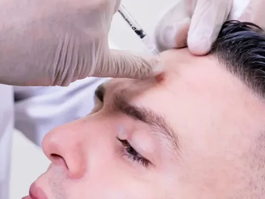 Man receiving a forehead injection from a gloved provider
