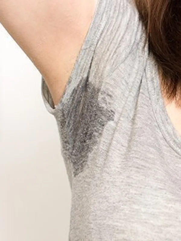 Botox for Excessive Sweating at The Dermatology, Laser & Vein Center in Cincinnati