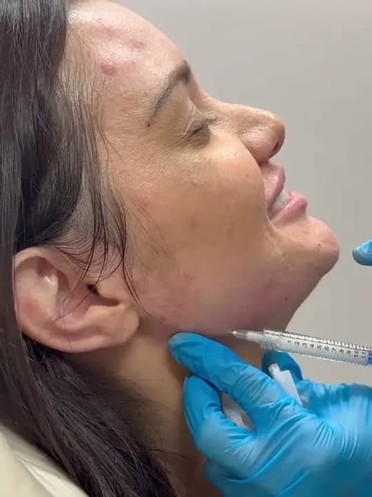 Lines & Wrinkles treatment at The Dermatology, Laser & Vein Center in Cincinnati