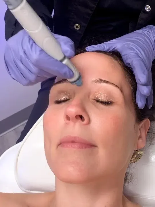 Texture & Large Pores treatment at The Dermatology, Laser & Vein Center in Cincinnati