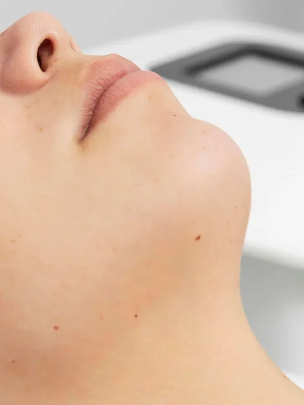 Dull & Tired Skin treatment at The Dermatology, Laser & Vein Center in Cincinnati