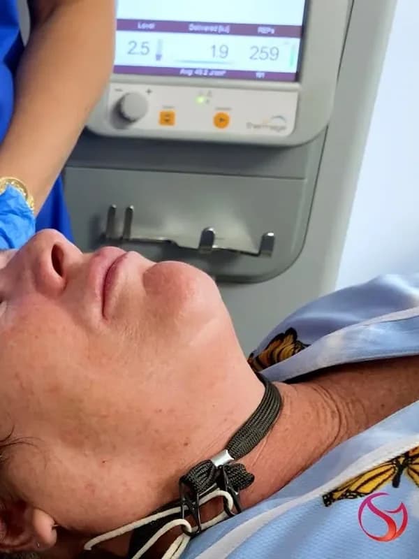 Thermage – Frequently Asked Questions at The Dermatology, Laser & Vein Center in Cincinnati