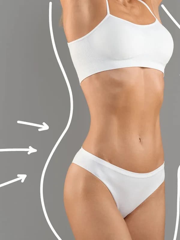 Stubborn Fat treatment at The Dermatology, Laser & Vein Center in Cincinnati