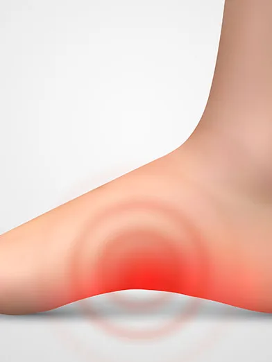 Joint & Heel Pain treatment at The Dermatology, Laser & Vein Center in Cincinnati