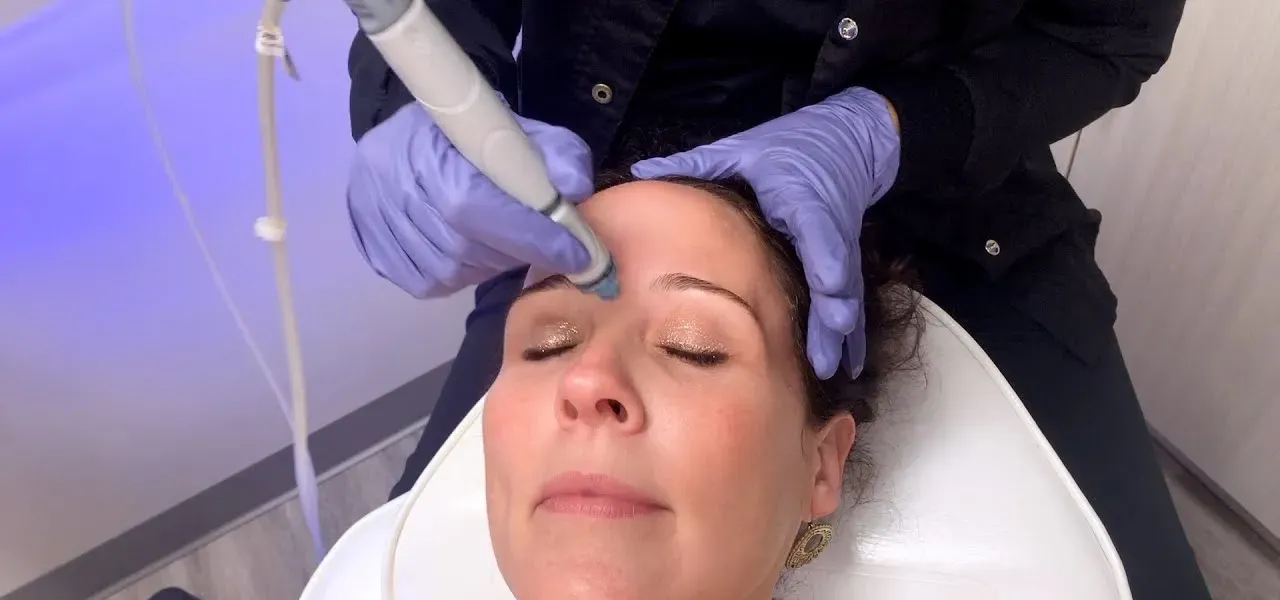 A HydraFacial treatment in progress at The Dermatology, Laser & Vein Center in Cincinnati